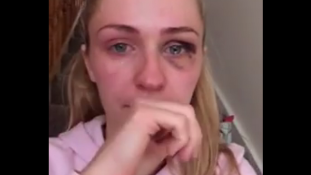 Brave Irish woman, Emma Murphy, who last week publicly posted on her Facebook page, a video accusing her former partner, fitness instructor Francis Usanga, ... - brave-emma-murphy-refuses-to-accept-ex-partners-apology-for-domestic-violence